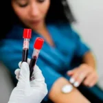 Alzheimer’s Blood Test May Predict When Symptoms Will Begin